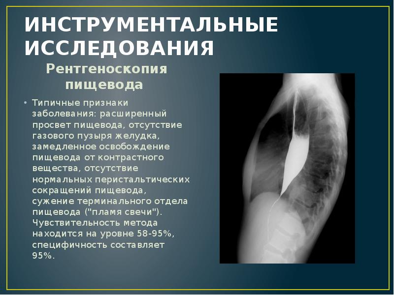 ИНСТРУМЕНТАЛЬНЫЕ ИССЛЕДОВАНИЯ
Рентгеноскопия пищевода ИНСТРУМЕНТАЛЬНЫЕ ИССЛЕДОВАНИЯ
Рентгеноскопия пищевода