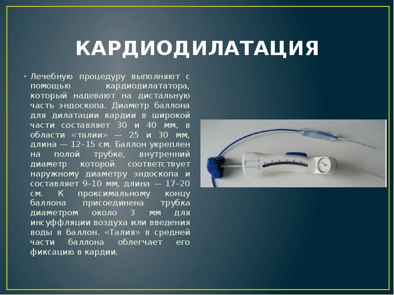 КАРДИОДИЛАТАЦИЯ
Лечебную процедуру выполняют с помощью кардиодилататора, который надевают на дистальную КАРДИОДИЛАТАЦИЯ
Лечебную процедуру выполняют с помощью кардиодилататора, который надевают на дистальную