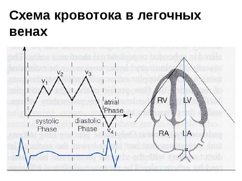 Легочных венах. Кровоток в легочных венах на ЭХОКГ. Оценка кровотока в легочных венах. Скорость кровотока в легочных венах. Спектр кровотока в лёгочных венах.