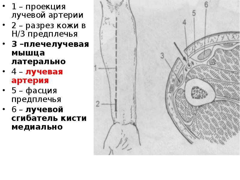 Алгоритм лучевая артерия