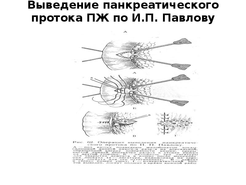 Выведение. Павлов изучение поджелудочной железы. Опыт Павлова на одном протоке поджелудочной железы. И. П. Павлов и г. а. Смирнов поджелудочной железы.