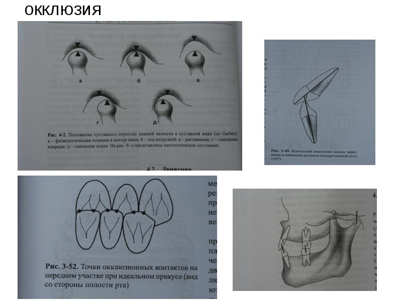 Биомеханика нижней челюсти презентация