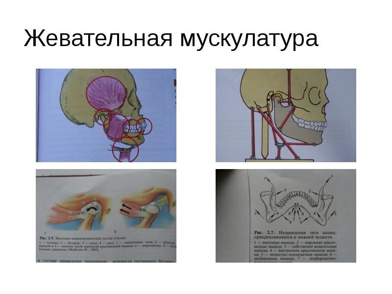 Биомеханика ортодонтия презентация