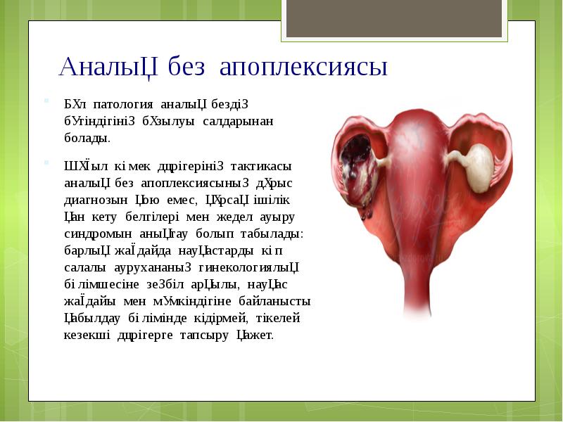 Аналық без апоплексиясы