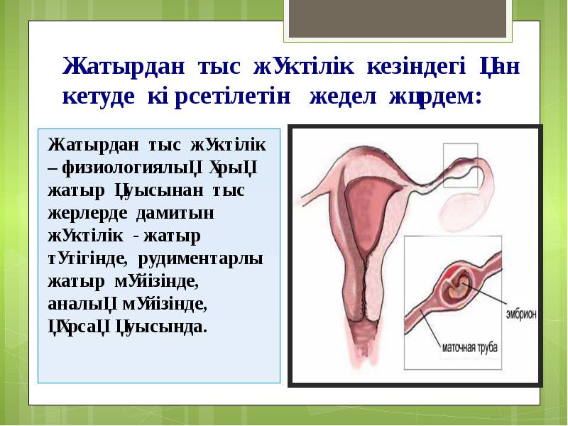 Жатырдан тыс жүктілік кезіндегі қан кетуде көрсетілетін  жедел жәрдем: