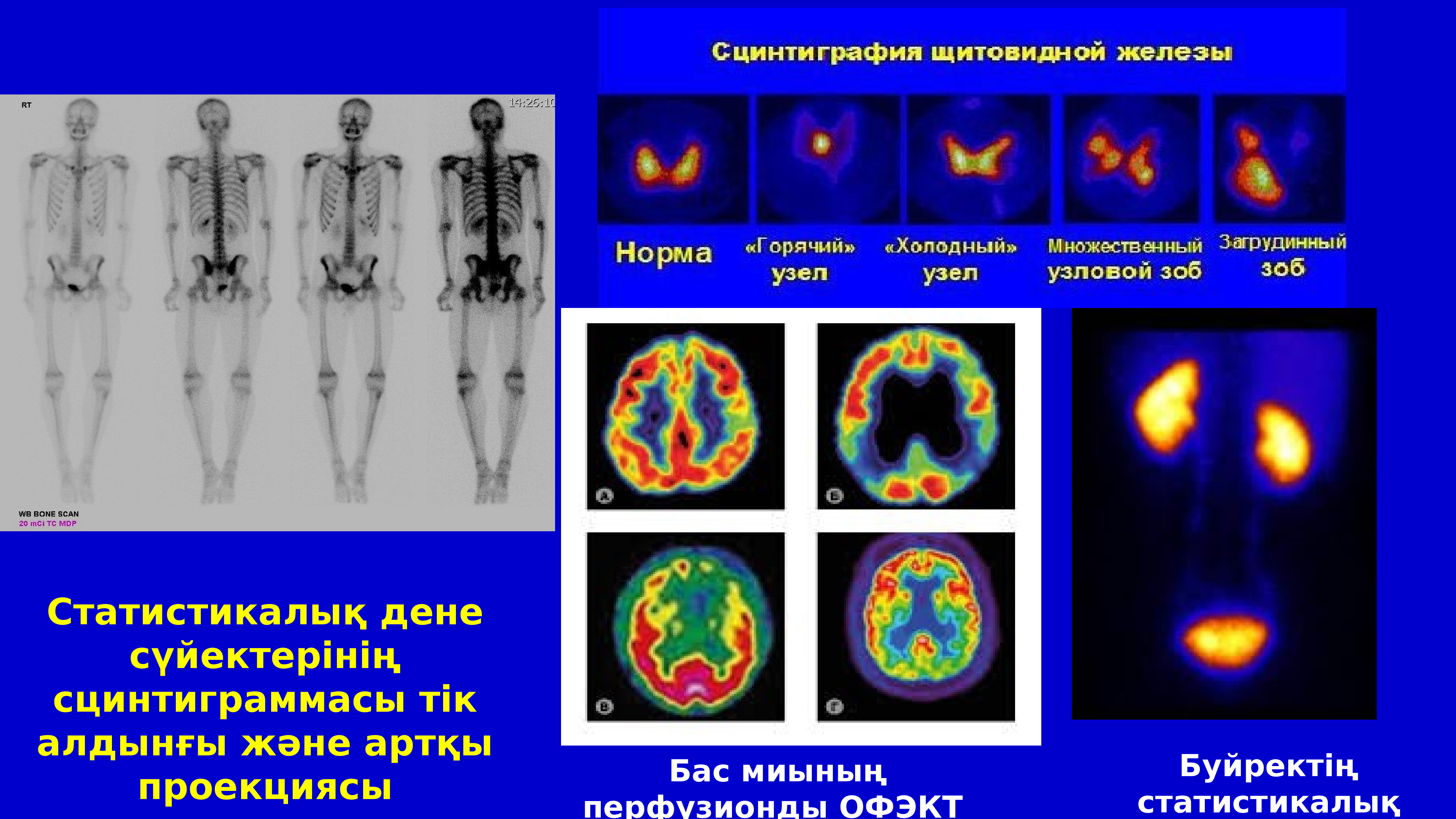 Сцинтиграмма является изображением