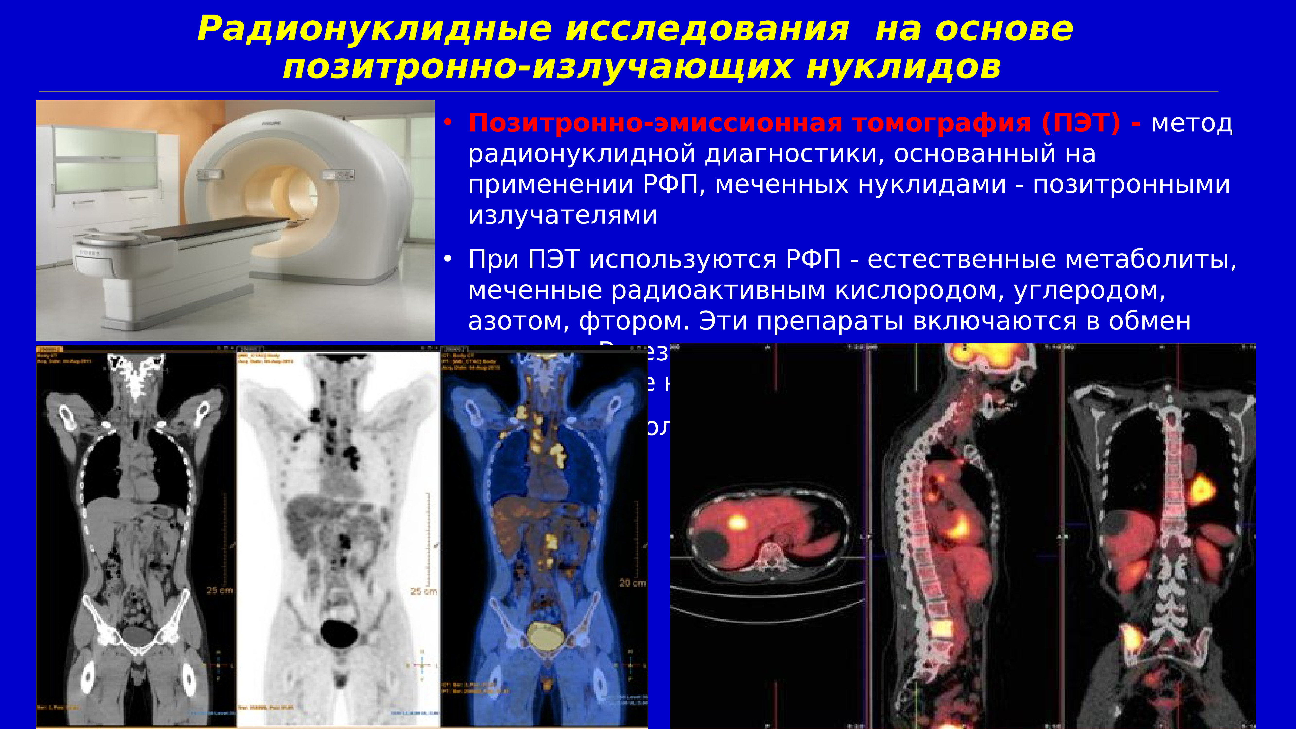 Рфп при пэт кт. Позитронно-эмиссионная томография (ПЭТ). ПЭТ кт костей онкология. ПЭТ лучевая диагностика.