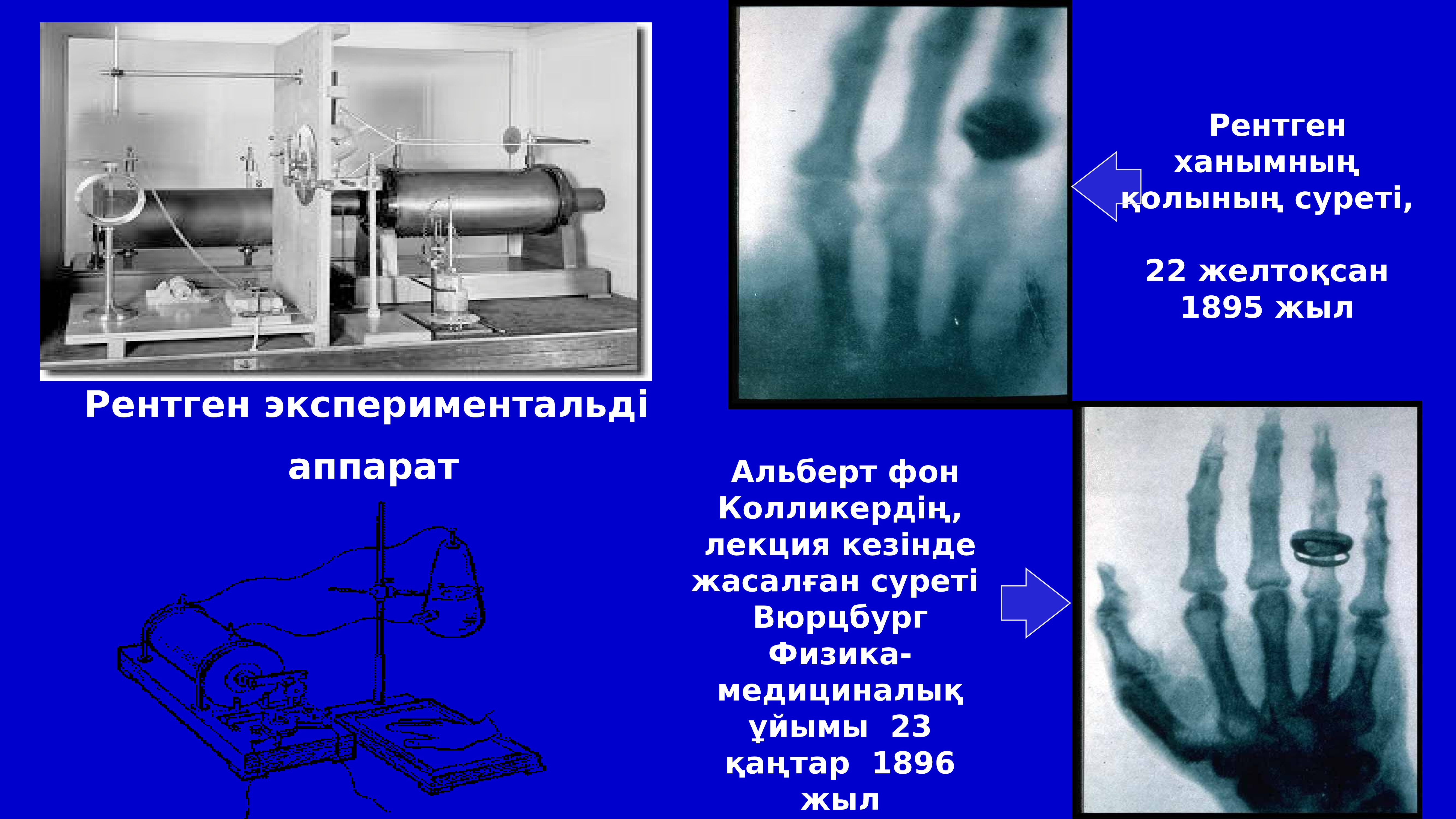 Презентация на тему рентген