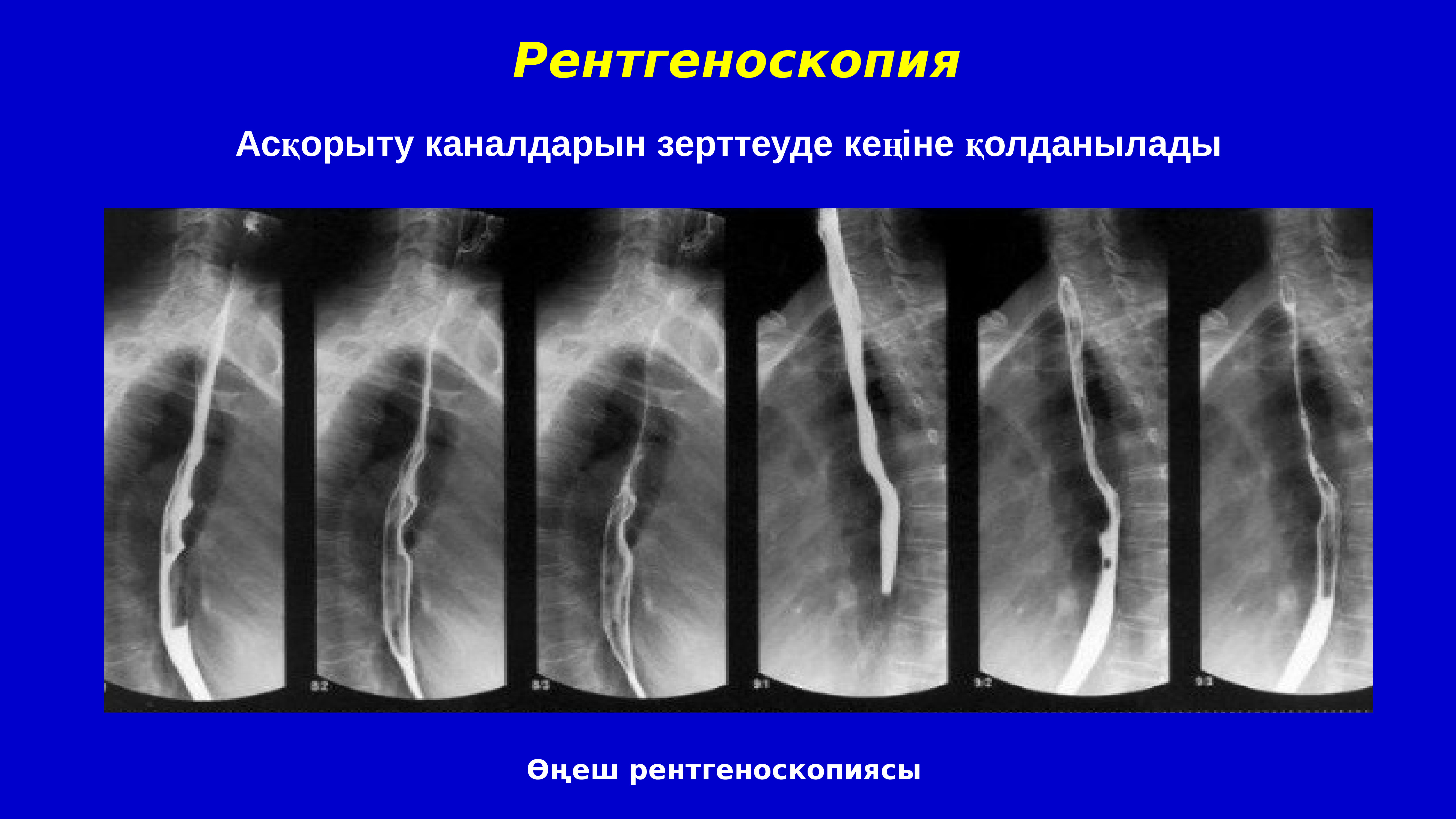 При рентгеноскопии изображение внутренних органов