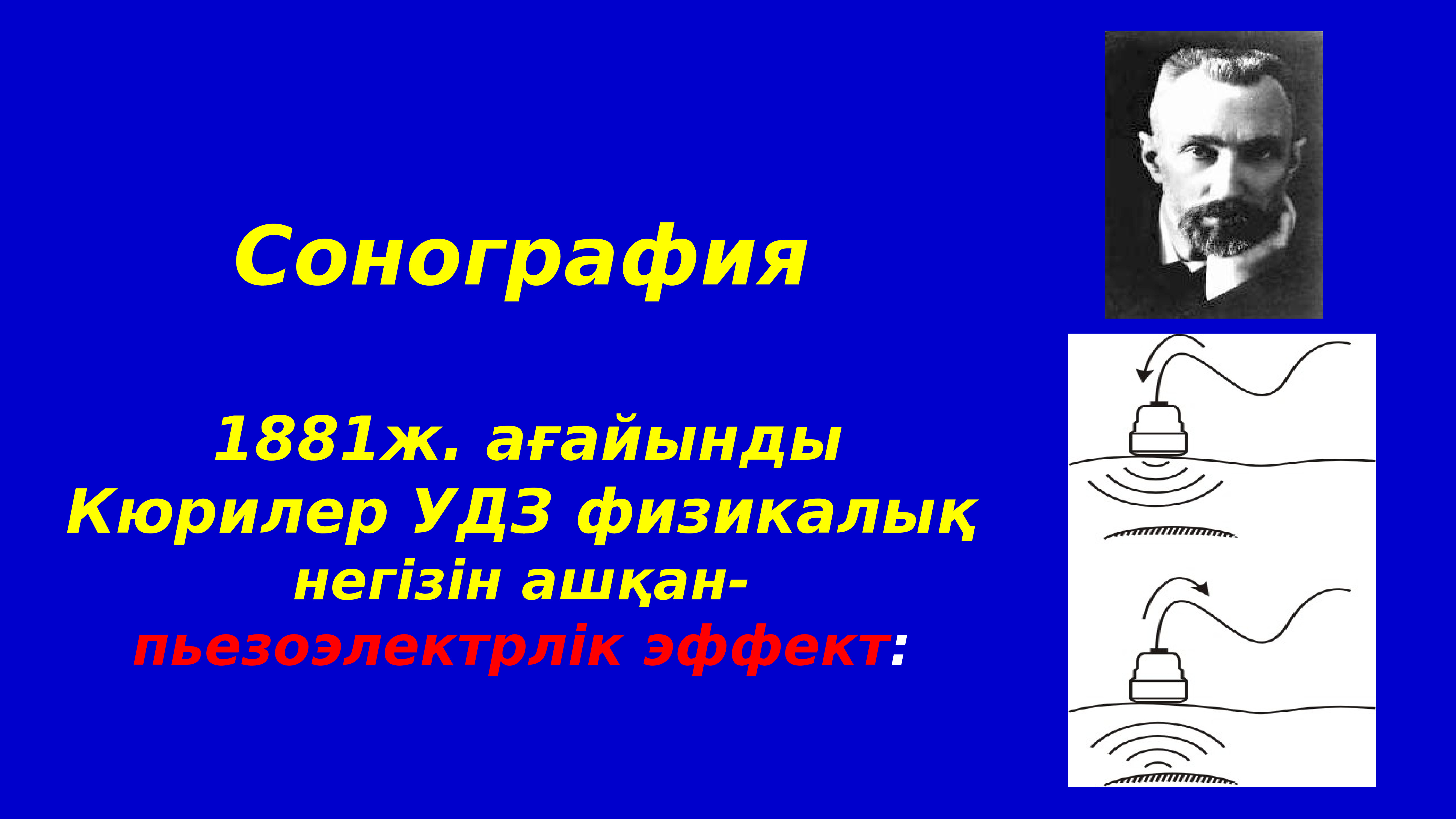 Перинатология негіздері презентация