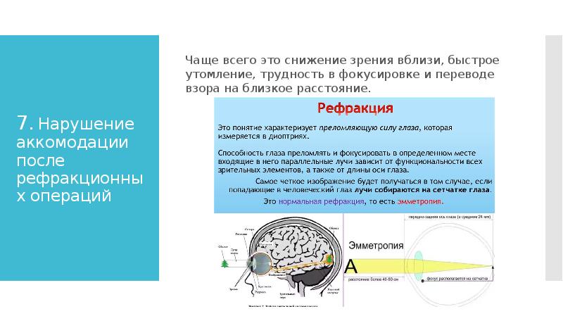 Механизм аккомодации презентация