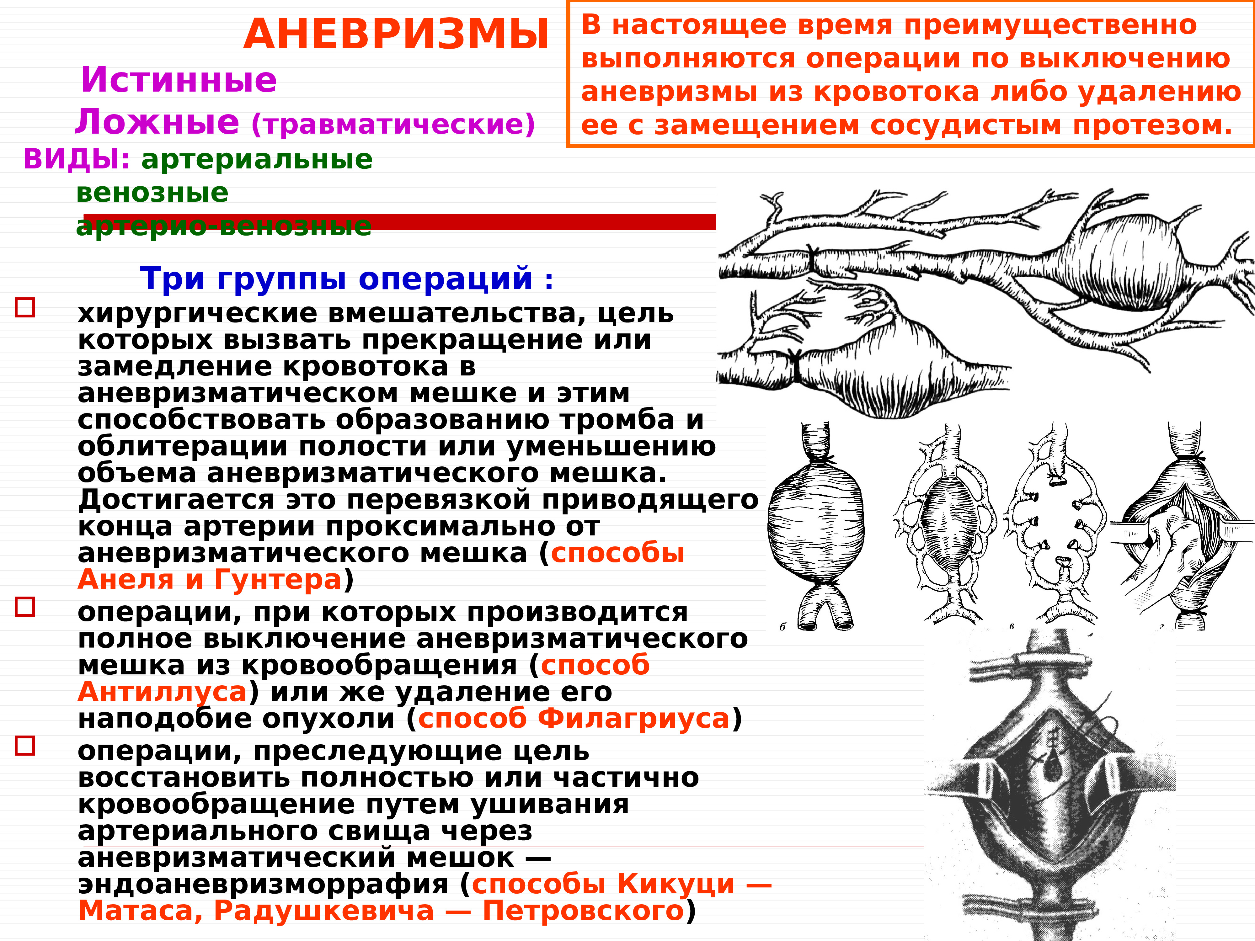 Операция истинная. Истинные и ложные аневризмы. Ложная артериальная аневризма. Операции при аневризмах. Итинная и лоная аневризм.