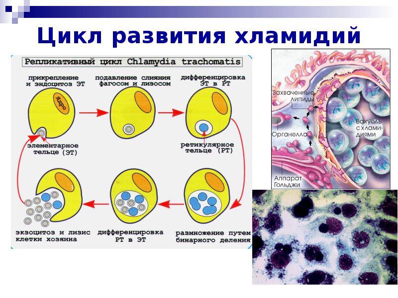 Виды хламидий. Хламидии клетки пораженные. Хламидии строение клетки. Строение хламидии микробиология рисунок. Хламидии строение микробиология.