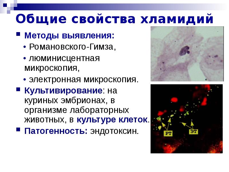 Определение хламидий. Метод выявления хламидий. Хламидии Романовскому Гимзе. Способы выявления хламидий. Chlamydia trachomatis микроскопия.