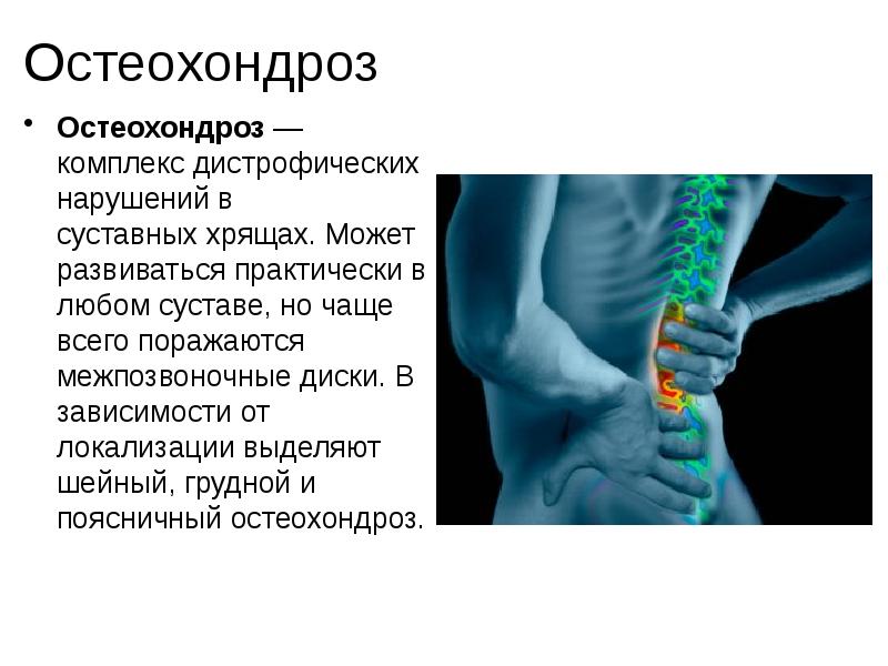 Клиническая картина метастатического поражения позвоночника отличается от остеохондроза