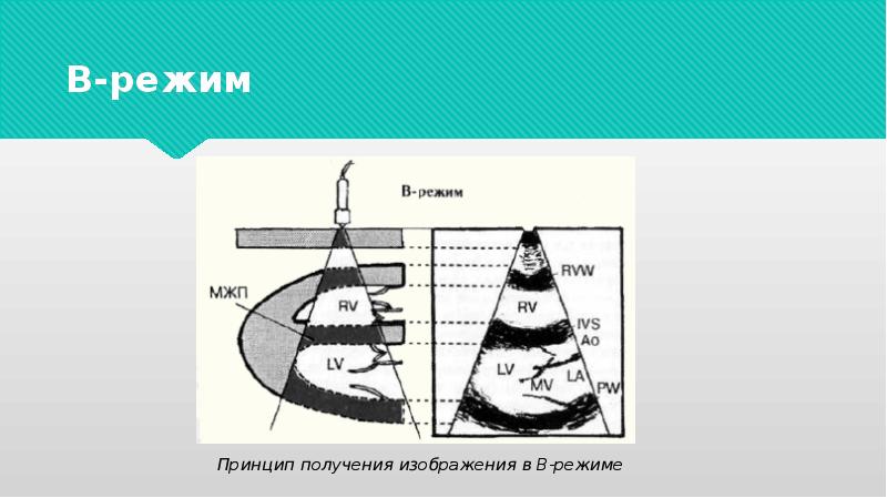 Принцип получения изображения