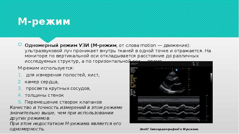 Принцип получения узи изображения основан на