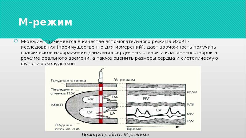 Принципы получения ультразвукового изображения сердца в трех режимах сканирования