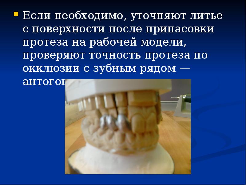 Если необходимо, уточняют литье с поверхности после припасовки протеза на рабочей Если необходимо, уточняют литье с поверхности после припасовки протеза на рабочей