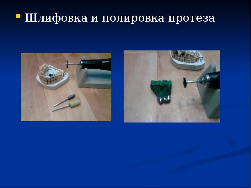 Шлифовка и полировка протеза
Шлифовка и полировка протеза Шлифовка и полировка протеза
Шлифовка и полировка протеза