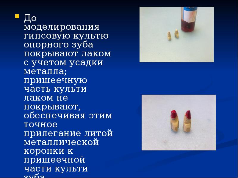 До моделирования гипсовую культю опорного зуба покрывают лаком с учетом усадки До моделирования гипсовую культю опорного зуба покрывают лаком с учетом усадки
