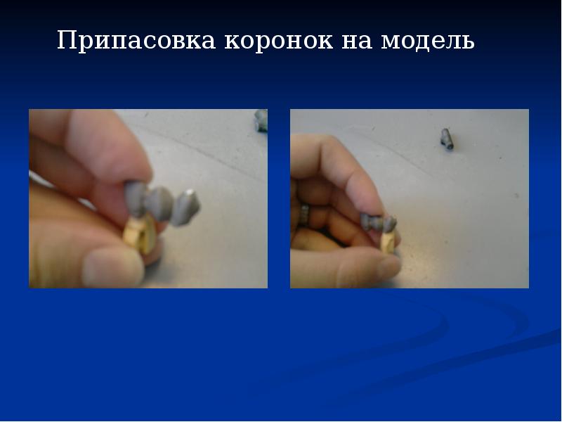 Припасовка коронок на модель
Припасовка коронок на модель Припасовка коронок на модель
Припасовка коронок на модель