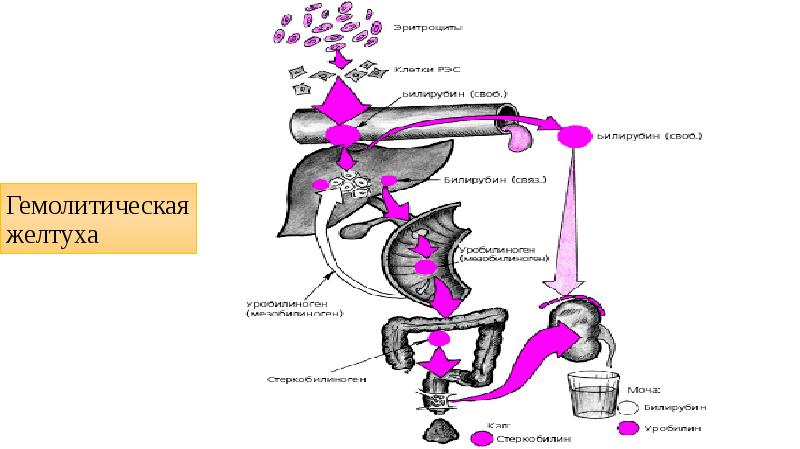 Механическая желтуха клинические рекомендации. Механизм развития гемолитической желтухи.