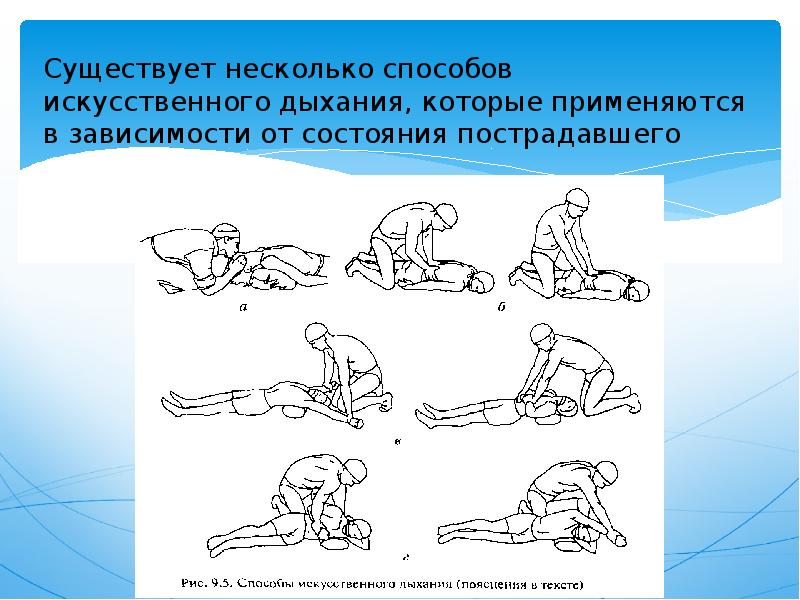 Презентация на тему изучение и освоение основных способов искусственного дыхания