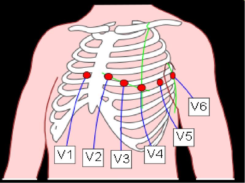 Схема кардиограммы как делать