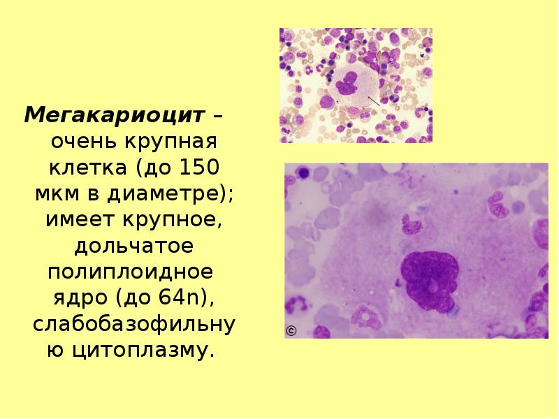 Мегакариоцит – очень крупная клетка (до 150 мкм в диаметре); имеет
