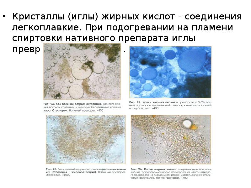 Иглы жирных кислот в кале у ребенка фото