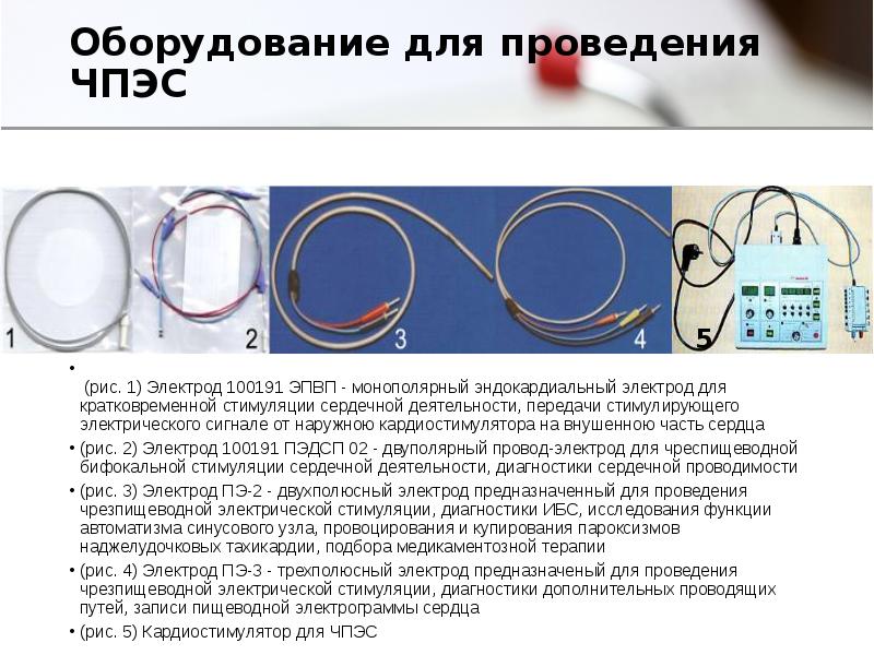 Установка кардиостимулятора плюсы и минусы