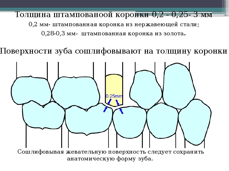 Штампованные коронки презентация