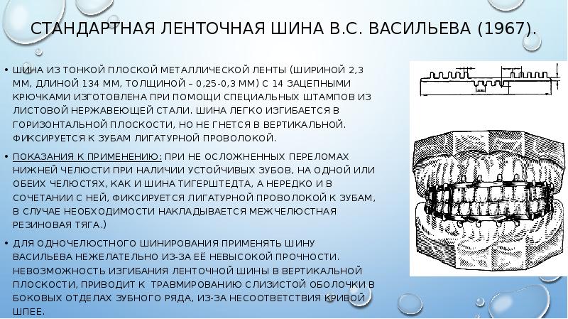 Наложение сложных шин и шин протезов презентация