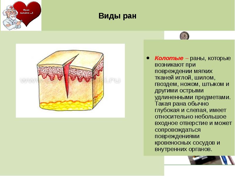 Раны осложнения ран