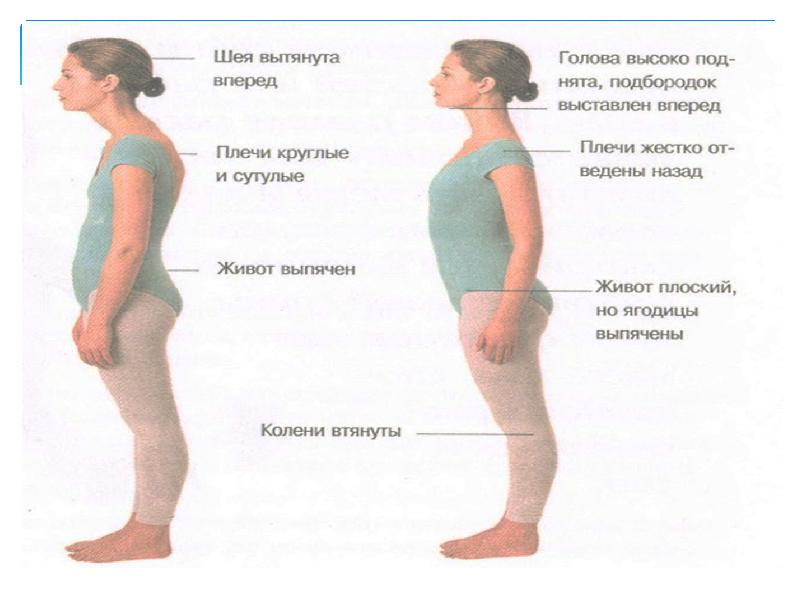 Проект на тему правильная осанка залог здоровья