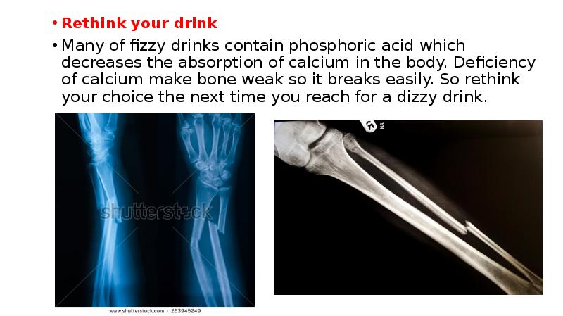 Rethink your drink
Many of fizzy drinks contain phosphoric acid which Rethink your drink
Many of fizzy drinks contain phosphoric acid which