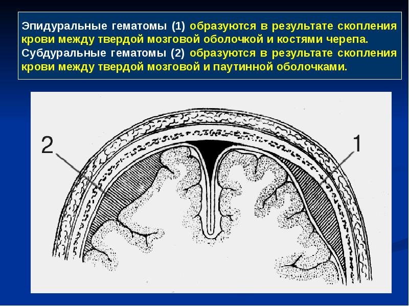 Операции на мозговом отделе головы презентация