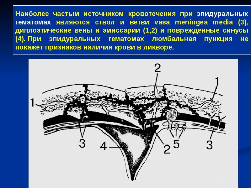 Операции на мозговом отделе головы презентация