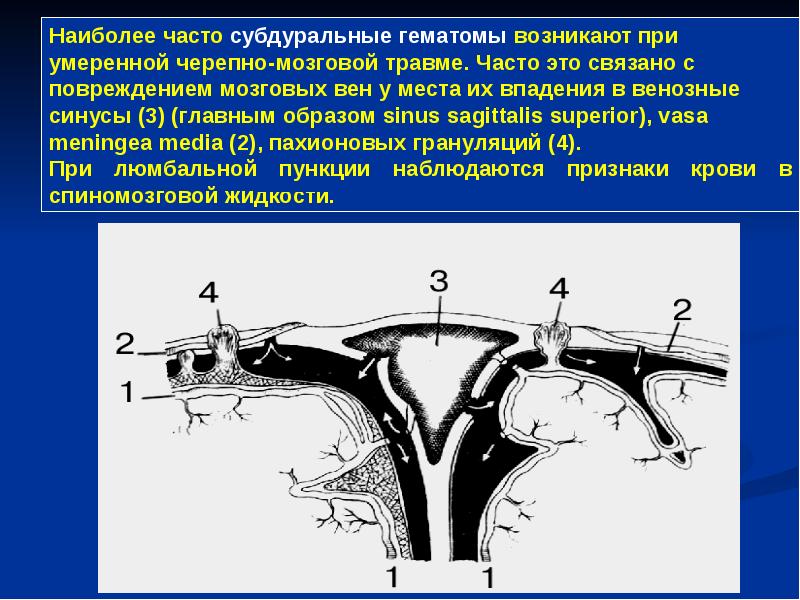 Операции на мозговом отделе головы презентация