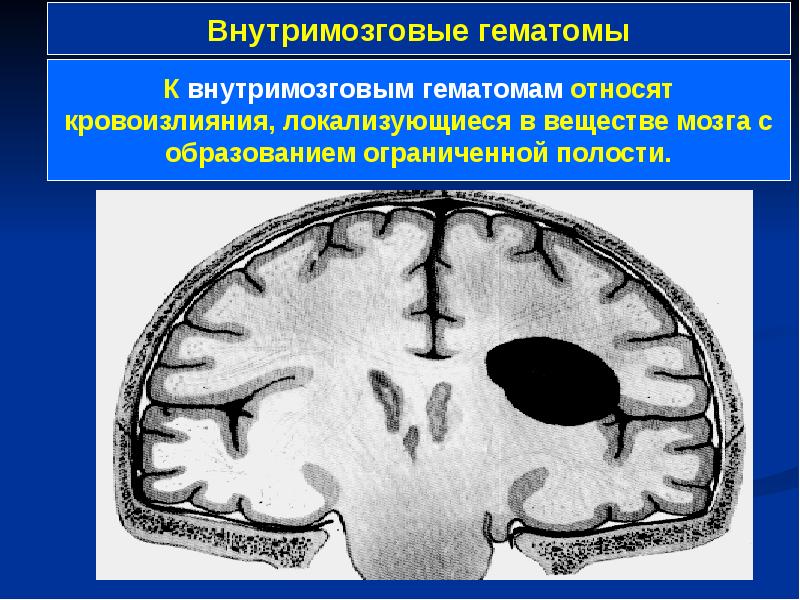 Операции на мозговом отделе головы презентация