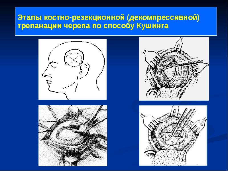 Операции на мозговом отделе головы презентация