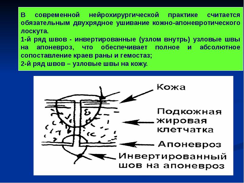 Операции на мозговом отделе головы презентация