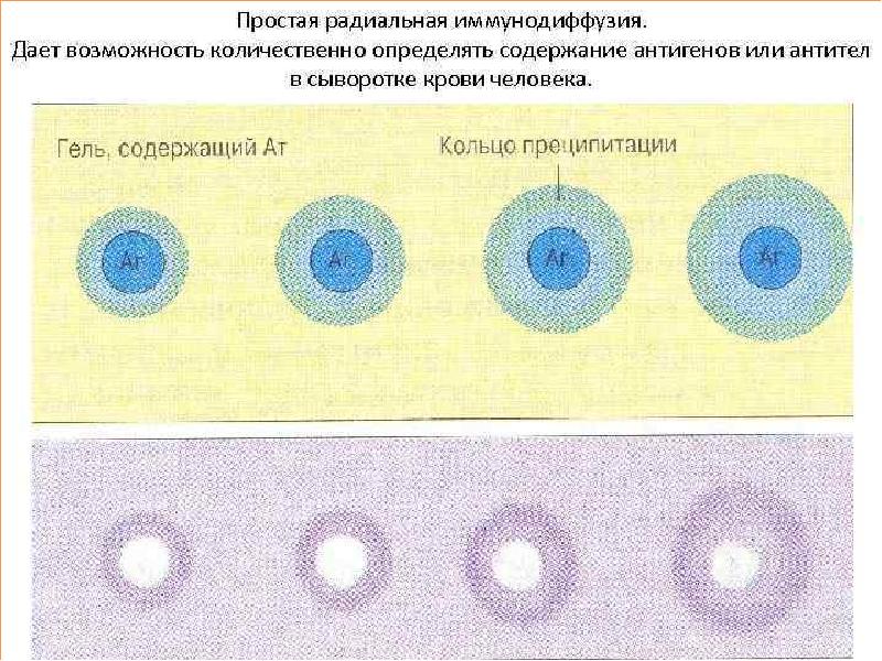 Радиальная иммунодиффузия по манчини презентация - 98 фото