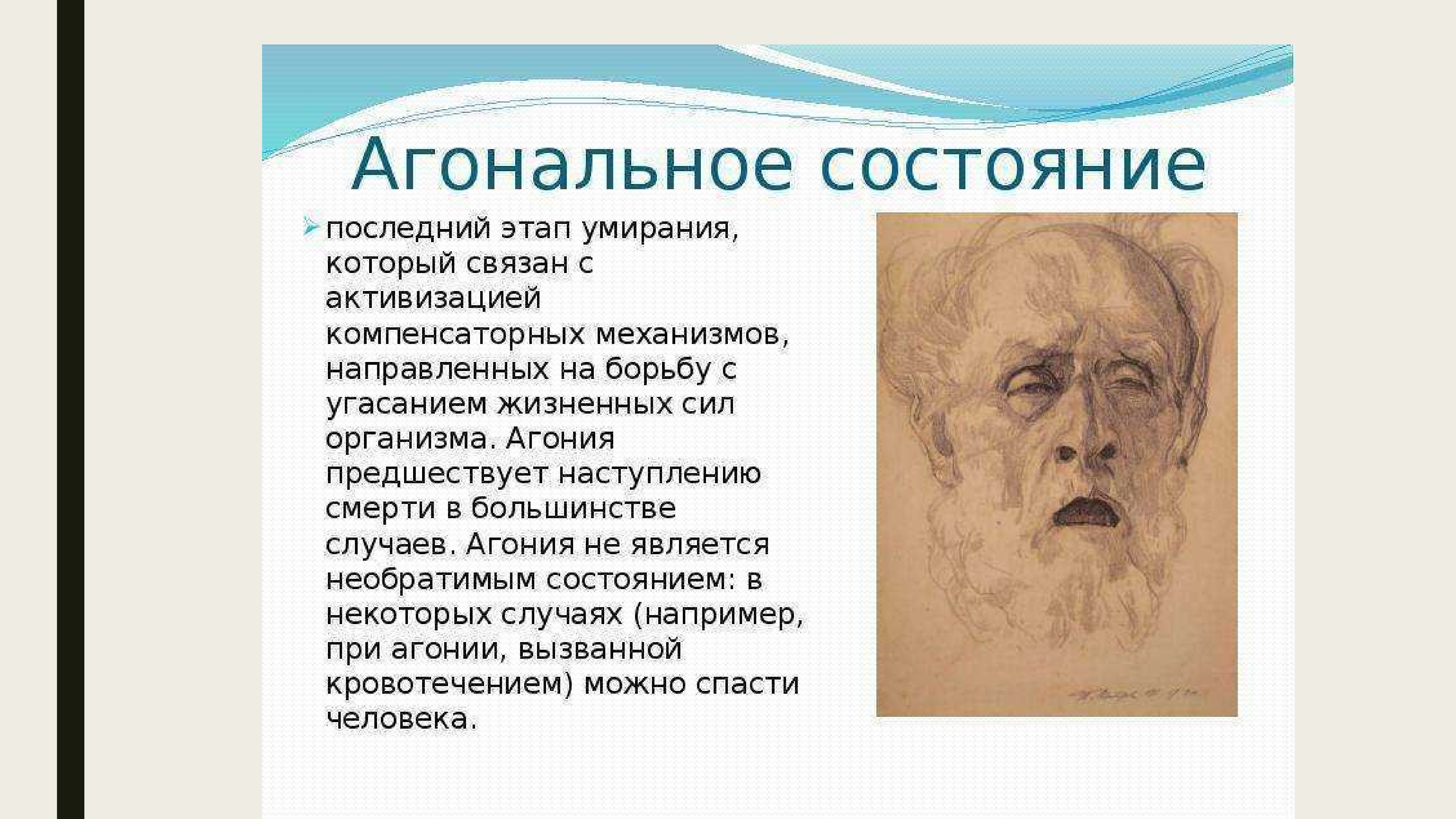 Состояние агонии. Вагонашьное состояние. Оганальлтное состояние. Что такое вогональное состояние.