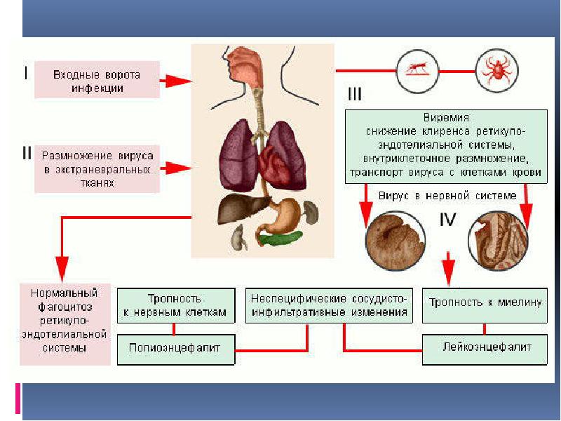 Воспаление мозгов. Клещевой вирусный энцефалит патогенез. Вирус клещевого энцефалита патогенез. Патогенез при клещевом энцефалите. Клещевой боррелиоз патогенез.