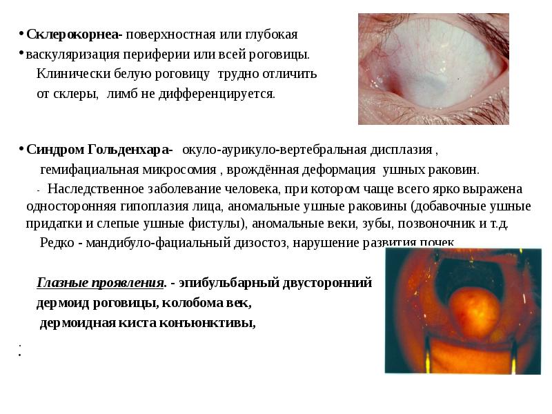 Презентация врожденные болезни