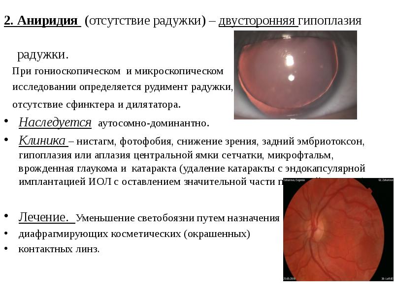 Презентация врожденные болезни