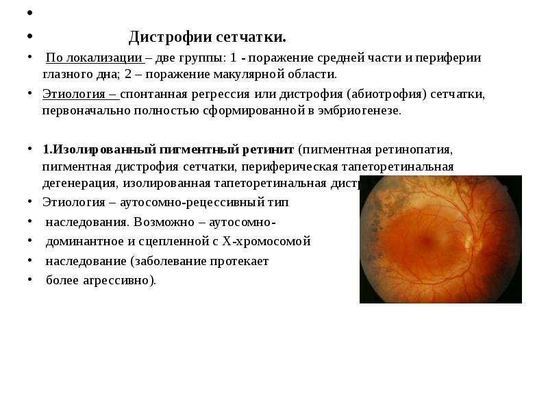 Презентация врожденные болезни