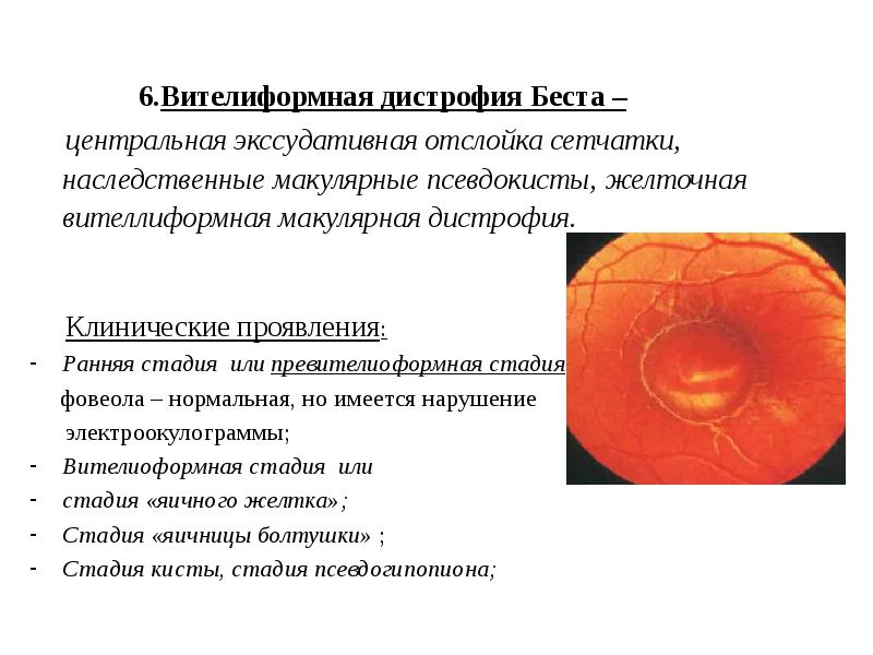 Заболевания органов зрения презентация